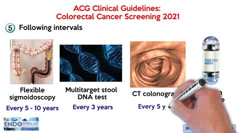 Colorectal Cancer Screening - ACG Clinical Guidelines: 2021 - YouTube