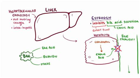 Cholestatic liver disease: Video, Anatomy & Definition | Osmosis