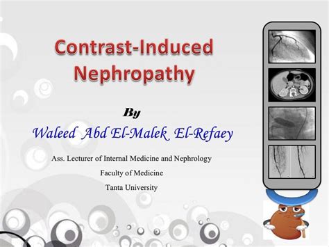 Contrast Induced Nephropathy