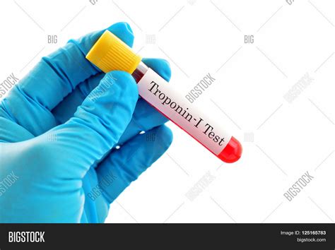 Test Tube Blood Sample Image & Photo (Free Trial) | Bigstock