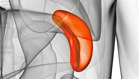 Spleen cancer: Causes, symptoms, and treatments