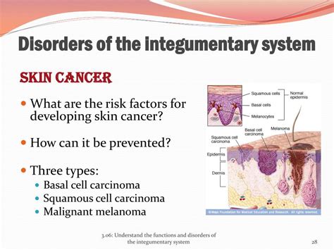 PPT - 3.06 Understand the functions and disorders of the integumentary system PowerPoint ...