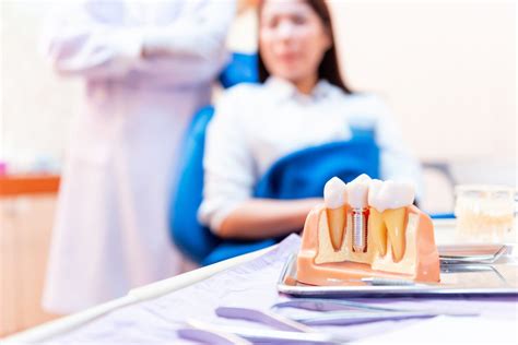 A Comprehensive Overview of Dental Implants: Complications and Risks ...