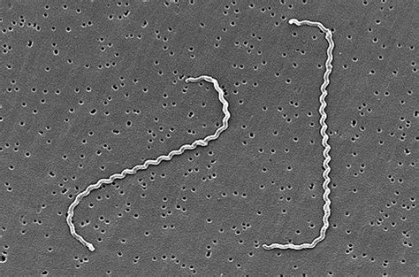 Leptospira interrogans - Wikipedia