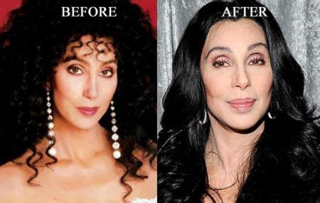 Goddess Of Pop, Cher Plastic Surgery Before And After Photos