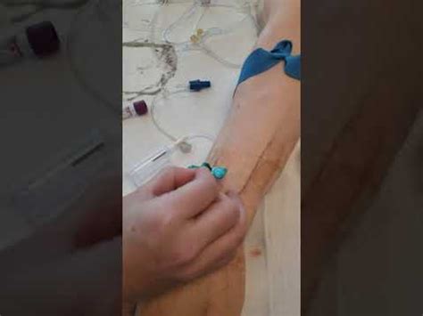 Blood draw using a butterfly needle - YouTube