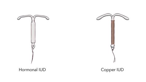 IUD Birth Control | Info About Mirena & Paragard IUDs