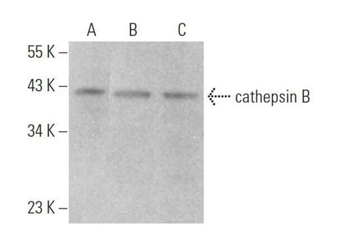 cathepsin B Antibody (H-5) | Santa Cruz Biotech