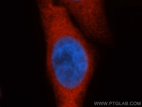 HSP70 Antibody (10995-1-AP)