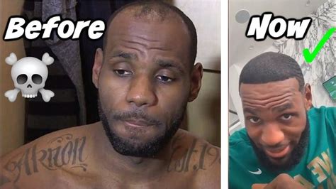 LEBRON JAMES' HAIRLINE HAS BEEN RESTORED! | Lebron hairline, Lebron james, Funny basketball memes