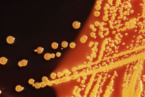 Escherichia coli (HE Agar) - DocCheck