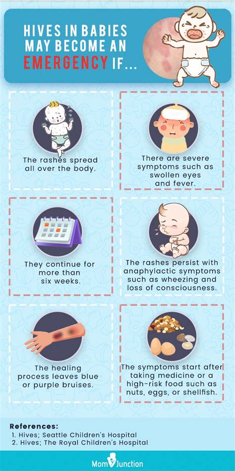 Hives On Baby: Causes, Symptoms, Treatment And Prevention | MomJunction