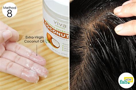 8 Best Home Remedies for Dry, Flaky Scalp That Work | Fab How