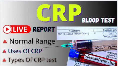 Crp Quantitative Blood Test High at Debra Hernandez blog