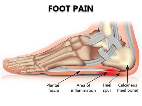 Foot Pain Treatment NYC | Foot Pain Specialists in New York