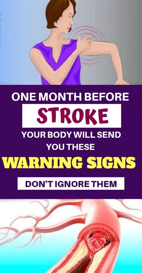 One Month Before Stroke Your Body Will Send You These Warning Signs – Healthy