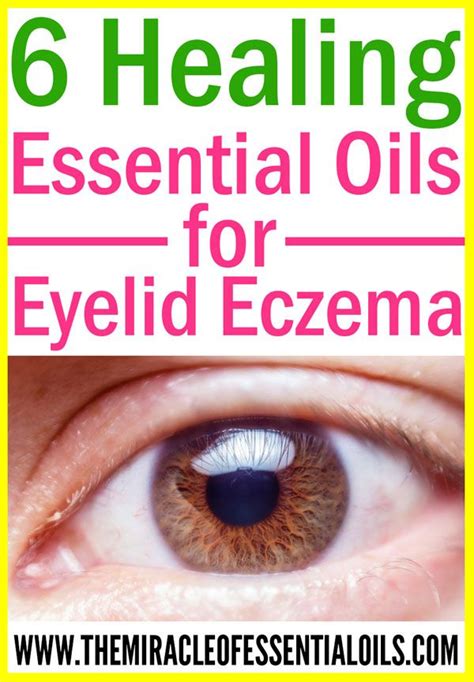 Check out these essential oils for eczema on eyelids to find natural ...