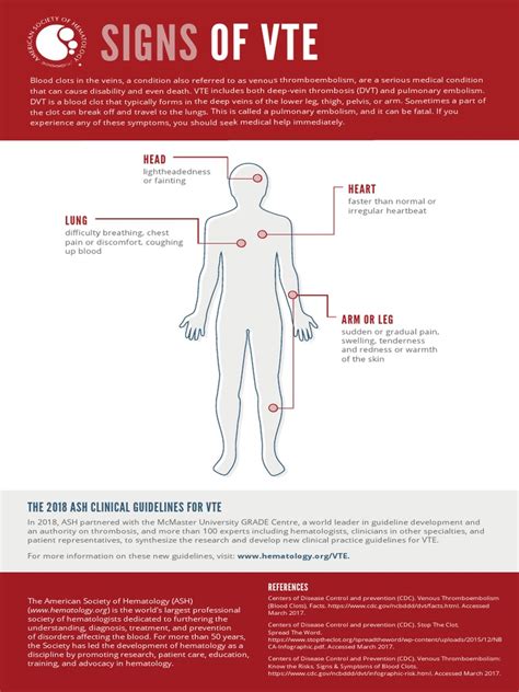 Signs of VTE Infographic PDF | PDF | Vein | Thrombosis