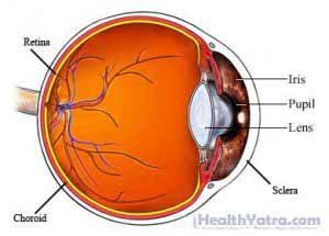 Chorioretinitis Definition, Causes, Symptoms, Complications and Cost ...