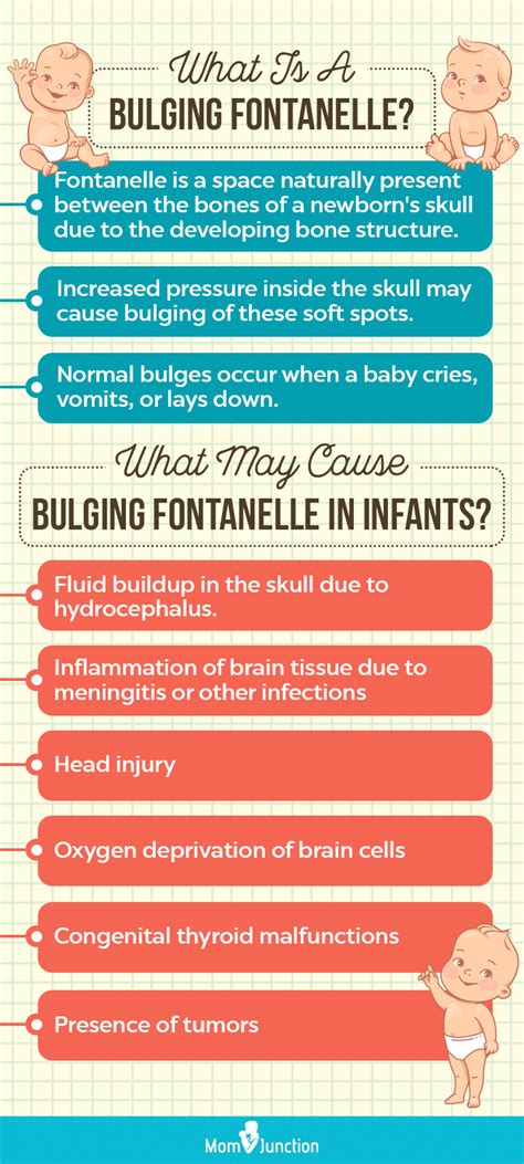 Bulging Fontanelle: Causes, Treatment When To See A Doctor, 48% OFF