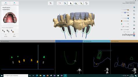 3Shape TRIOS 4 Wireless Pod INTRAORAL SCANNER | Universadent Inc