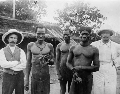 The Hacked Hands of the Belgian Congo: Horrifying Photos of Mutilated Congolese People in the ...