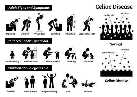 Celiac Disease Signs Symptoms Problems Illness Allergic - Etsy in 2022 | Signs and symptoms ...