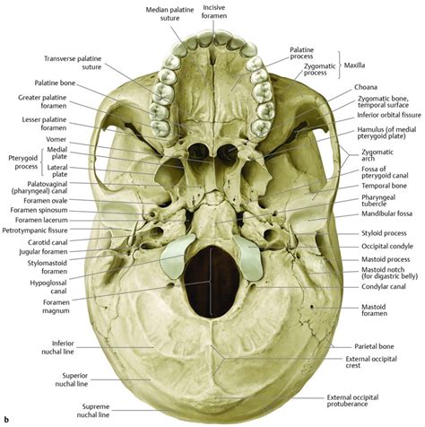 16 Skull Base and Cranial Nerves | Radiology Key