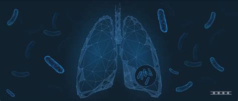 Understanding Latent Tuberculosis Diagnosis | Clinical Lab Products