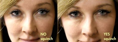 Learn This Eye Squinch to Look Better in Photos | Dr. Brett Kotlus, Cosmetic Oculoplastic ...