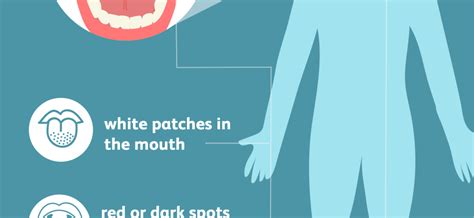 Leukoplakia – symptoms, causes, types, treatment – Healthy Food Near Me