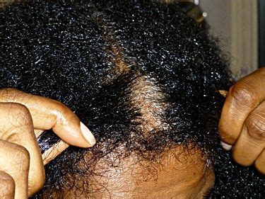 How to Treat Dry Scalp in African American Hair • DryScalpGone ...