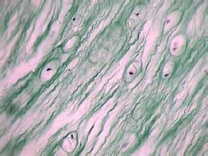 Histology Slides: Fibrocartilage