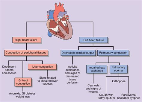 Right versus Left sided heart failure | Cardiac nursing, Heart failure