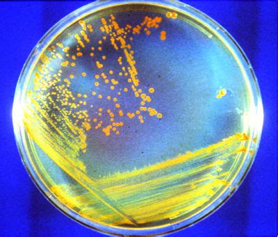 Deinococcus - microbewiki