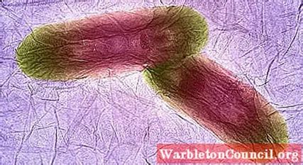 Cronobacter Sakazakii: Characteristics, Diseases - science - 2024