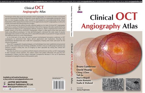 OCT angiography