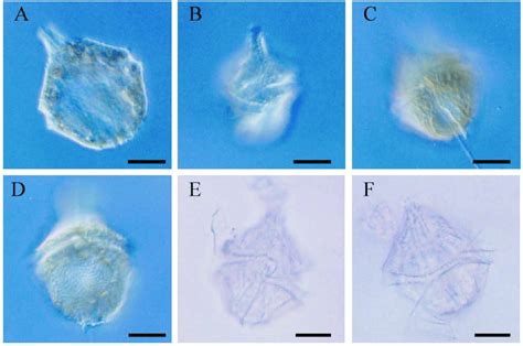 Microphotographs of dinoflagellate Gonyaulax polygramma by a light... | Download Scientific Diagram