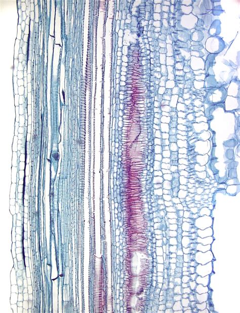 ‎Protoxylem vessel elements with annular secondary wall thickenings and metaxylem elements with ...