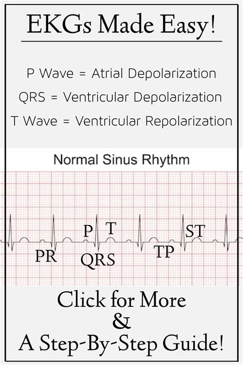 EKG Interpretation and Rhythm Made Easy: Nursing and Medical Cheat Sheet Notes | Nursing school ...