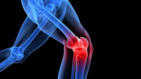 Our Approach to Knee Injections | The Knee Clinic Calgary