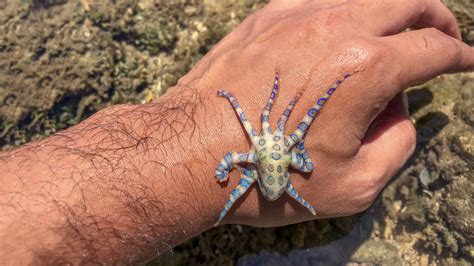 Blue-Ringed Octopus Bite Symptoms and Emergency First Aid