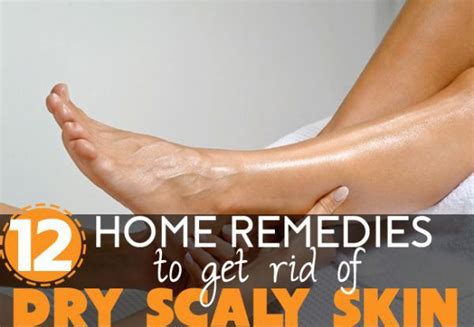 The 25+ best Dry scaly skin ideas on Pinterest | Feet care, Heel fissures and Geletin face mask