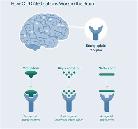 MAT: Medication Assisted Treatment - Drug & Alcohol Addiction Treatment Services