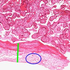 Placenta / Fetal Membranes Histology Virtual Slide Review Flashcards | Quizlet