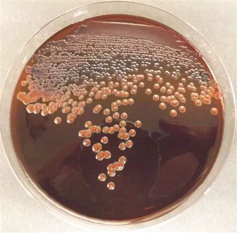 EMB (Eosin Methylene Blue) Agar - Plate, Composition and Results - Laboratoryinfo.com