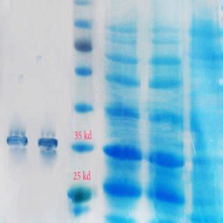 The Coomassie blue-stained 12.5% SDS-PAGE gel, showing induction of the... | Download Scientific ...