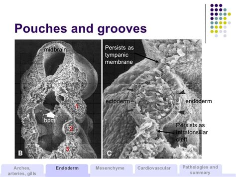 Development Of The Branchial Arches