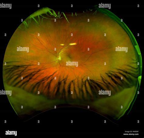 Retinal Scan High Resolution Stock Photography and Images - Alamy