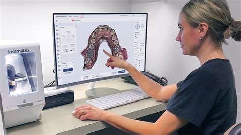 CAD/CAM Dentistry: Evolution of Crown Design | Glidewell